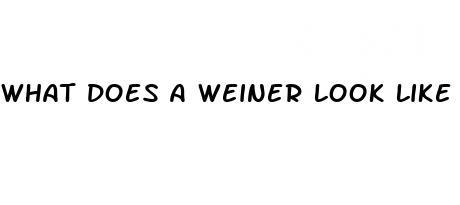 what does a weiner look like