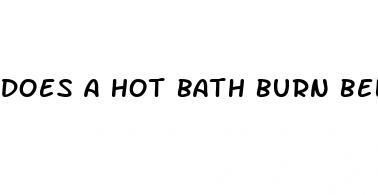 does a hot bath burn belly fat